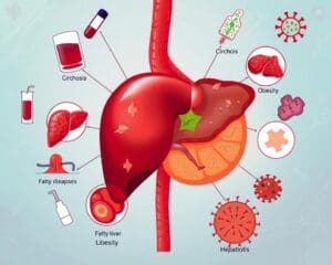 Lebererkrankungen: Ursachen und Behandlungsmöglichkeiten